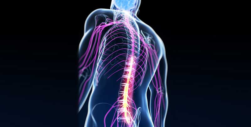 Neuromuscular Disorders